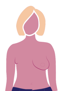 Custom Breast Prostheses  Personal Symmetrics Mastectomy Services